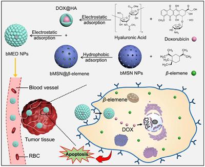 Construction of Biocompatible Dual-Drug Loaded Complicated Nanoparticles for in vivo Improvement of Synergistic Chemotherapy in Esophageal Cancer